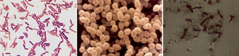 E. coli, fecal enterococcus, and proteus are major causes of chronic bacterial prostatitis