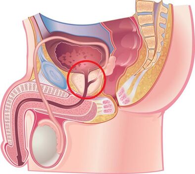 Location of the prostate in men
