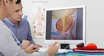 diagnosing prostatitis in a man